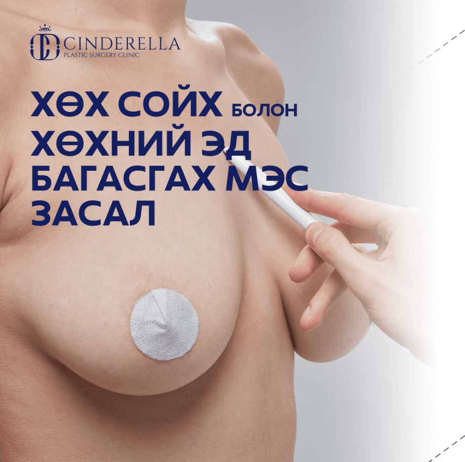Хөх сойх